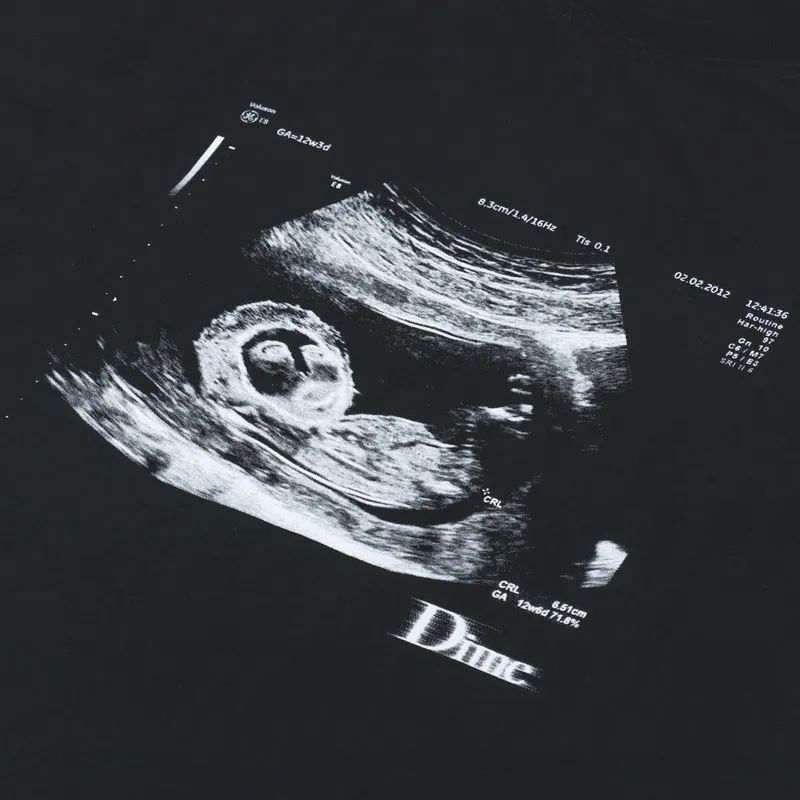 Dime Immaculate Restoration T Shirt Black-1